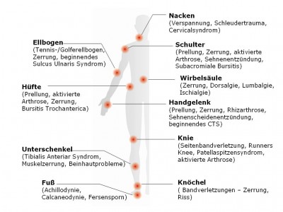 Beispiel an verschiedenen Arten von Schmerzen die mit REPULS behandelt werden können.